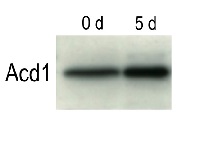 ACD1 | Accelerated cell death 1  in the group Antibodies Plant/Algal  / Plant Developmental Biology / Senescence/Cell death at Agrisera AB (Antibodies for research) (AS11 1783)